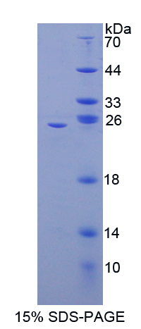 SDS-PAGE